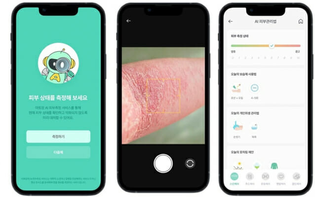 아토맘, ‘AI 피부건강측정서비스’ 앱(APP) 서비스 화면