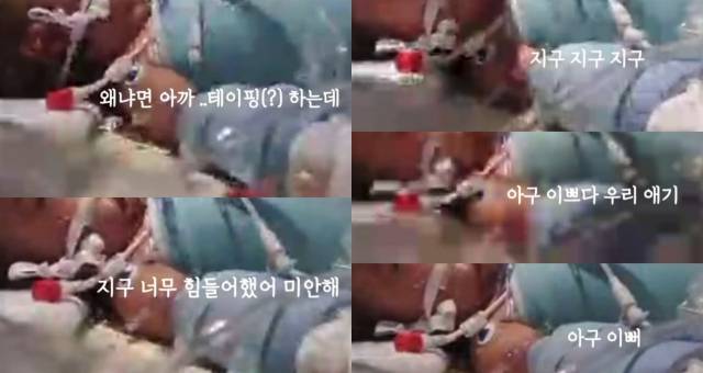 소아중환자실에 입원한 지구양에게 간호사가 말을 건네고 있다. 인스타그램 jigoo_____ 캡처