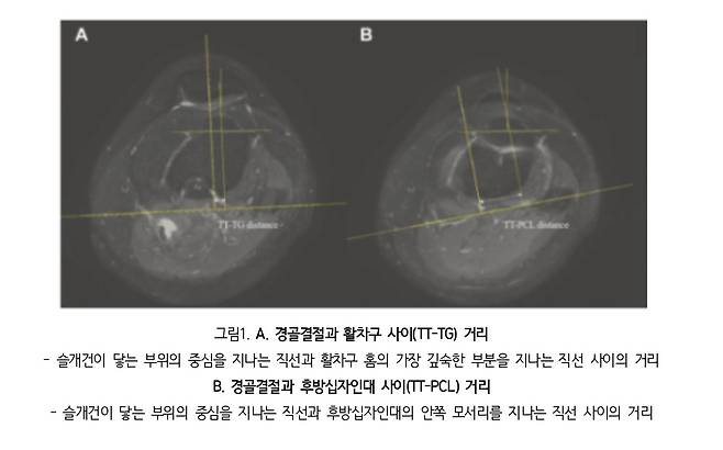 [분당서울대병원 제공]