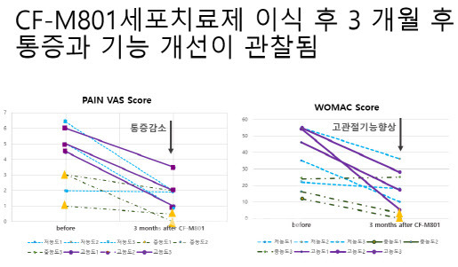 세포바이오 대퇴골두 골괴사 세포치료제 임상1상 기능 개선 그래프 (자료=세포바이오)