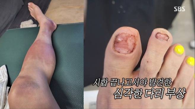 [서울=뉴시스] 지난 6일 방송된 SBS TV 예능물 '미운 우리 새끼'에는 배우 박선영이 출연했다. (사진=SBS TV 예능물 '미운 우리 새끼' 캡처) 2023.08.07. photo@newsis.com *재판매 및 DB 금지