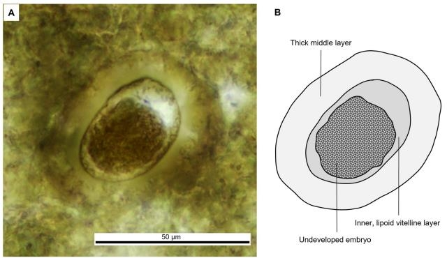 똥화석 속에서 발견된 아스카리디다목 선충류의 알 [PLOS ONE. Thanit Nonsrirach et al. 논문 캡처. 재판매 및 DB 금지]