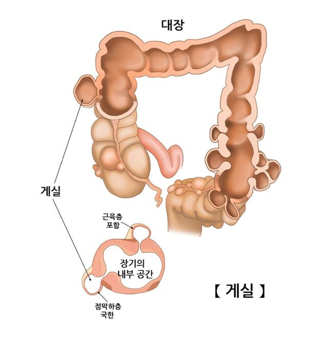 서울아산병원 제공