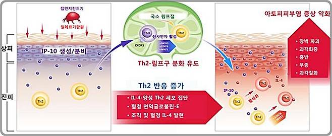 [대전=뉴시스] 집먼지진드기 민감성 아토피피부염에서 IP-10의 생산과 작용 기전. *재판매 및 DB 금지