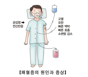 서울아산병원 제공