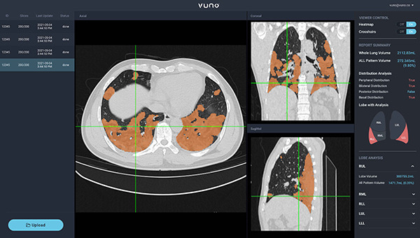 VUNO AI-based diagnostic software. [Courtesy of VUNO]