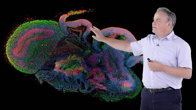 오스트리아 분자생명공학연구원(IMBA)의 위르겐 크노블리히 박사가 인간 뇌 오가노이드의 현미경 사진을 보며 설명하고 있다./오스트리아 과학원 분자생명공학연구원(IMBA)