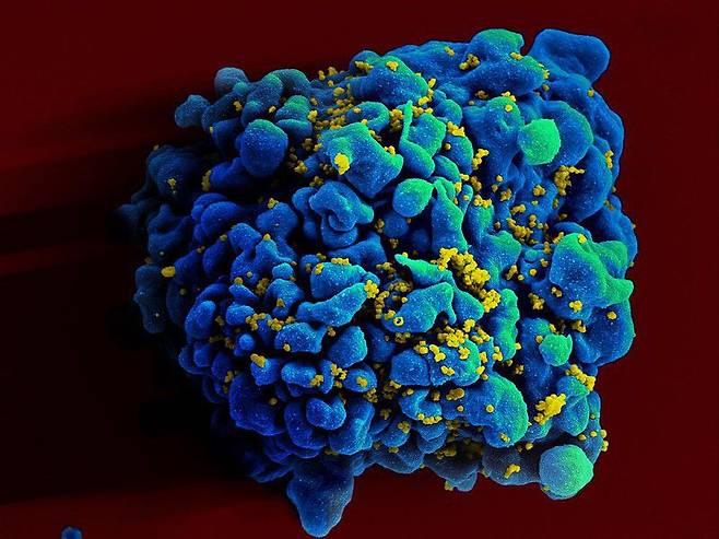 면역세포인 T세포에 감염된 에이즈 바이러스(노란색)의 전자현미경 사진./NIAID