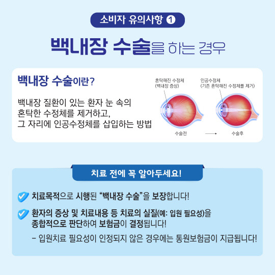 백내장 실손의료보험 보상 시 소비자 유의사항. [사진=손해보험협회]