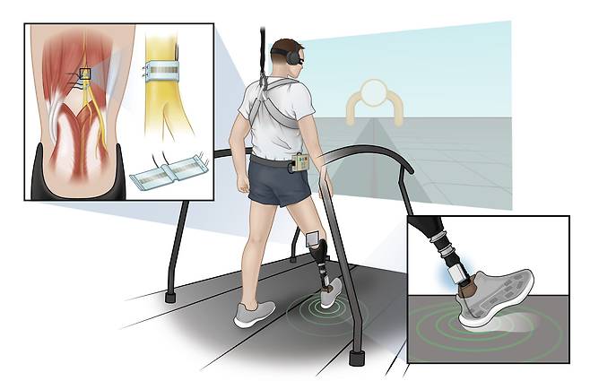 하미드 차르카르 미국 케이스웨스턴리저브대 생의학공학과 교수 연구진은 신경 감각을 재현한 의족을 개발했다./사이언스 로보틱스