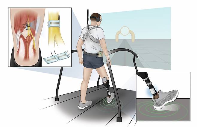 보행 중 실제 사지에서 발생하는 것처럼 발바닥 체성감각을 제공하는 신경 인터페이스 기술 및 감각신경의족.[고려대학교 제공]