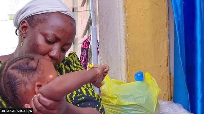 [서울=뉴시스]나이지리아에서는 지난해 12월 디프테리아 발병이 시작된 후 지금까지 600명이 넘는 사망자가 발생했다고 나이지리아 관리들이 밝혔다고 BBC가 12일 보도했다. <사진 출처 : BBC> 2023.10.12.