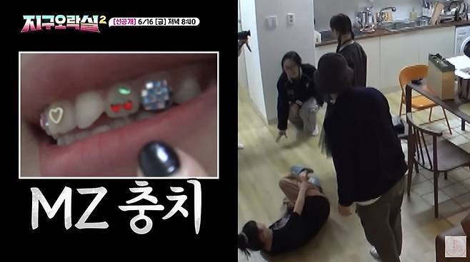 래퍼 이영지도 방송 등에서 체리 모양 투스젬을 공개했다. [사진= tvN '뿅뿅 지구오락실2']