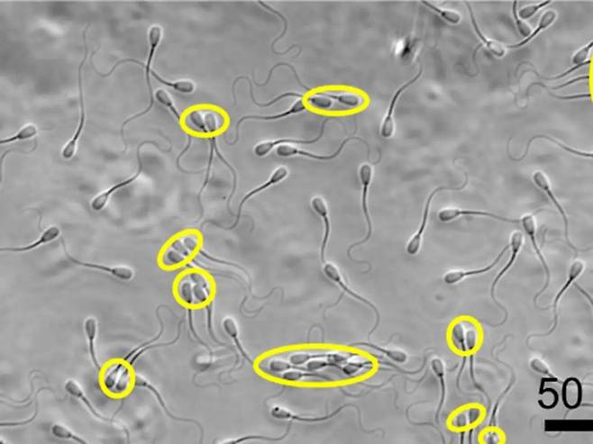 무리를 지어 이동하는 소 정자들(노란 타원 안)은 개별 정자보다 점도가 높은 체액이 흐르는 생식기 안에서 더 잘 이동했다./미 노스 캐롤라이나 농업기술주립대