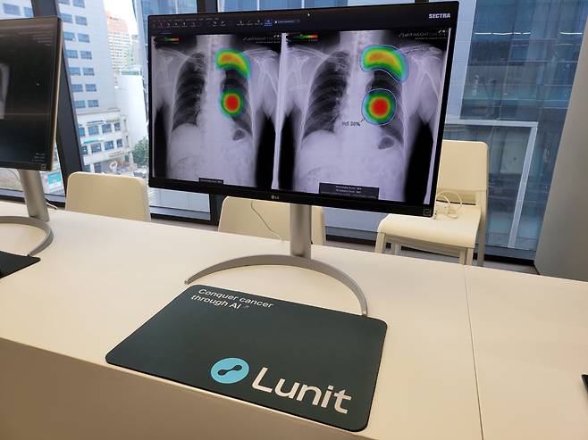 흉부 엑스레이 영상분석 의료 AI '루닛 인사이트 CXR'. 루닛은 국내 기업들 중 가장 먼저 캔서문샷에 합류했다./뉴스1