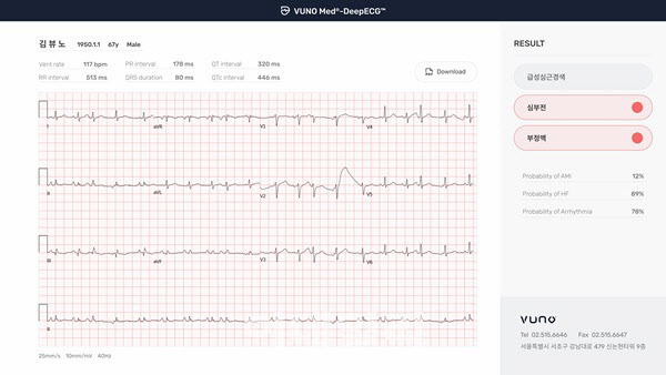 뷰노메드 딥ECG™ 운영화면 예시.(사진=뷰노)