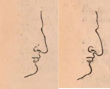 빅토리아 시대의 관상학에 따른 '로마인 코(좌)'와 '유대인 코(우)' .(1852) Notes on Noses, George Jabet