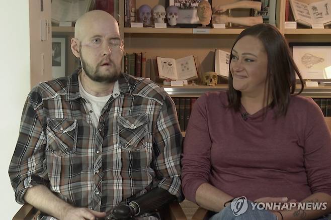 안면·안구 '이중이식' 수술을 받은 애런 제임스와 그의 아내  [AP 연합뉴스 자료사진. 재판매 및 DB 금지. 미국 뉴욕대(NYU) 랑곤헬스 제공]