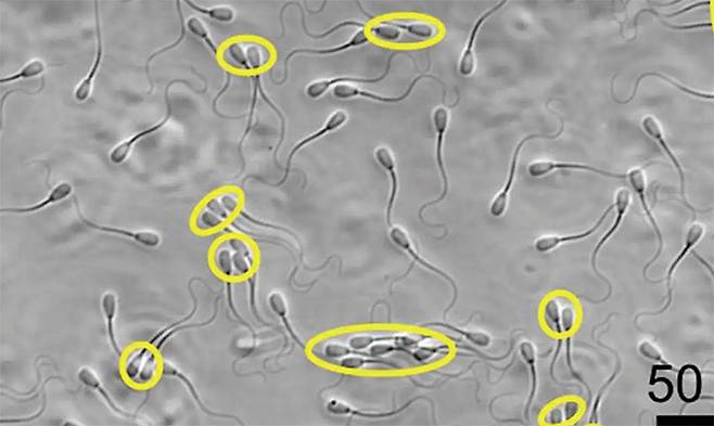 무리를 지어 이동하는 소 정자들(노란 타원 안)은 개별 정자보다 점도가 높은 체액이 흐르는 생식기 안에서 더 잘 이동했다. 사진 미국 노스캐롤라이나주 농업기술주립대