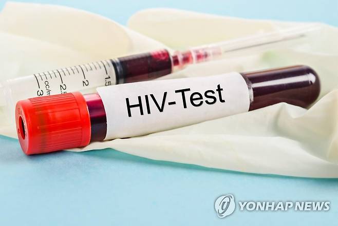 HIV 혈액 검사 [게티이미지뱅크 제공]