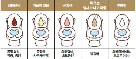 사진=헬스조선DB