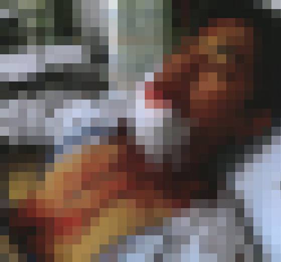 지난해 12월 폭행을 당한 직후 피투성이된 피해자가 응급실에 실려온 모습. 뉴스1