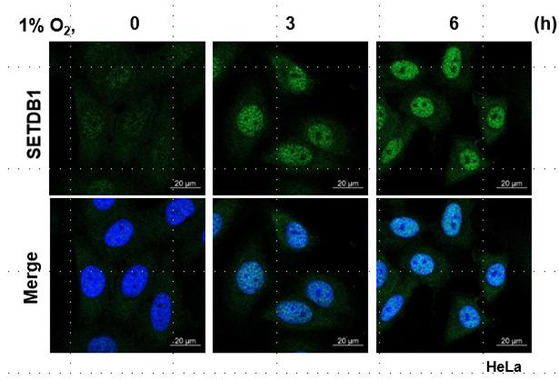 저산소 환경에서 특정 단백질(SETDB1)이 증가하는 모습