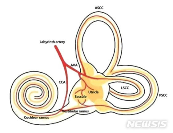 [서울=뉴시스]어지럼증과 후반고리관 기능 저하를 동반한 돌발성 난청의 경우 기존 스테로이드 치료 결과가 불량해 혈관 장애가 원인일 가능성이 높다는 연구 결과가 나왔다. 고압산소 치료나 항응고요법 등을 초기부터 병행하는 치료법을 고려할 필요가 있다는 지적이다. 이미지는 달팽이관 모습. (이미지= 강북삼성병원 제공) 2024.01.04. photo@newsis.com.