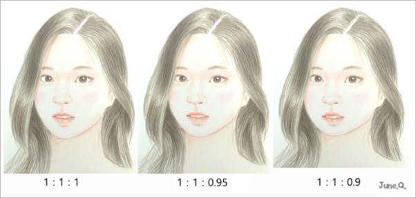 턱(하안면)이 짧으면, 이마(상안면)와 중안면이 넓어 보입니다.