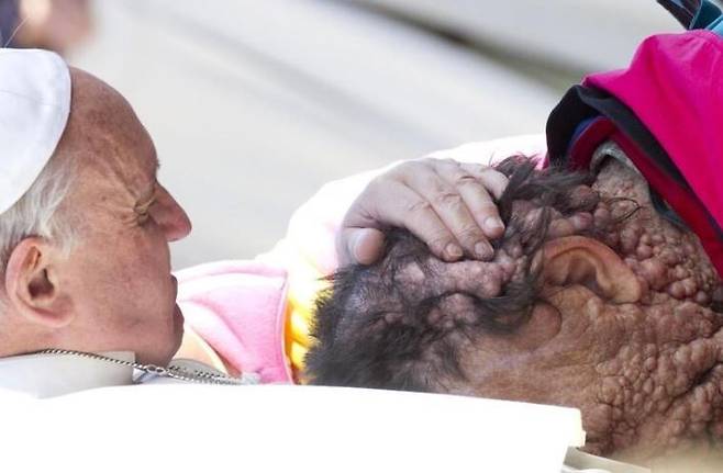 2013년 비니치오 리바의 머리 어루만지는 프란치스코 교황 / 사진 = 연합뉴스