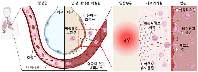 정상인과 만성 폐쇄성 폐질환 환자의 호중구 혈관내피세포외 이동 모습. (화학연 제공)/뉴스1