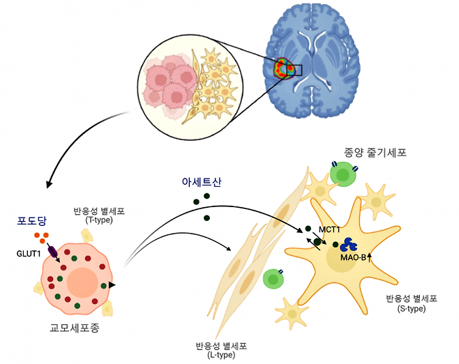 종양 미세환경에서 종양세포 유래 아세트산을 이상 과다 흡수하여 일어나는 반응성 별세포화 기전. IBS