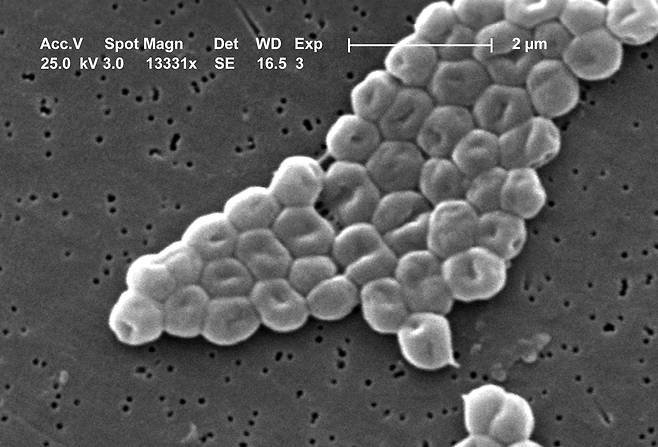 전자 현미경으로 촬영한 아시네토박터 바우마니(Acinetobacter baumannii)균. 대표적인 항생제 내성균 중 하나. / 질병통제예방센터(CDC)