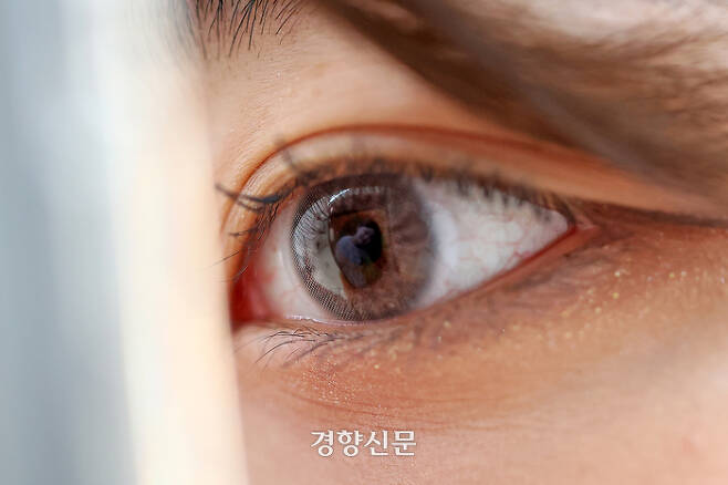 김혜미씨가 자신의 몸에서 가장 좋아하는 부위는 눈이다. 사진은 김씨의 눈동자에 자신의 모습이 비치고 있는 모습. 조태형 기자