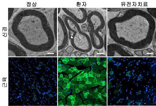 샤르코 마리 투스병 2Z(CMT2Z) 시료에 유전자 치료제를 적용한 모습. (사진=서울대) ⓒ 뉴스1