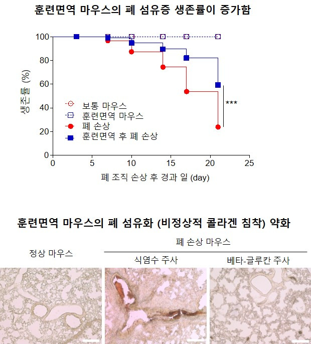 배타-글루칸으로 유도한 훈련면역이 마우스 폐 섬유증을 완화시킴ⓒ한국연구재단 제공