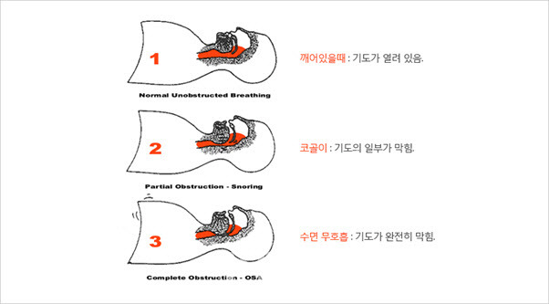 (대한 수면연구학회)