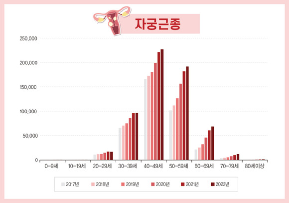 2022년 한해에만 자궁근종으로 병원을 찾은 환자는 60만7526명에 달했다. [사진=강동경희대병원]