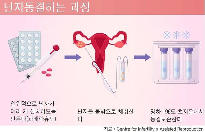 난자 동결하는 과정.
