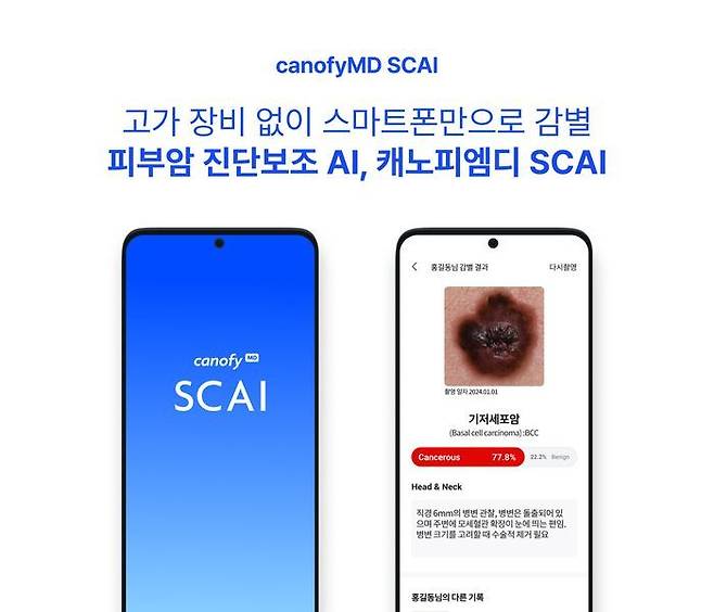 캐노피엠디 SCAI 서비스 화면 이미지 ⓒ라이프시맨틱스