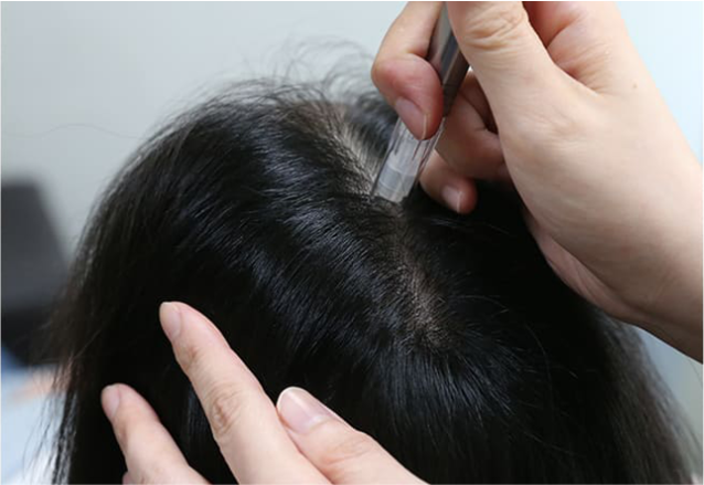 모제림성형외과 제공