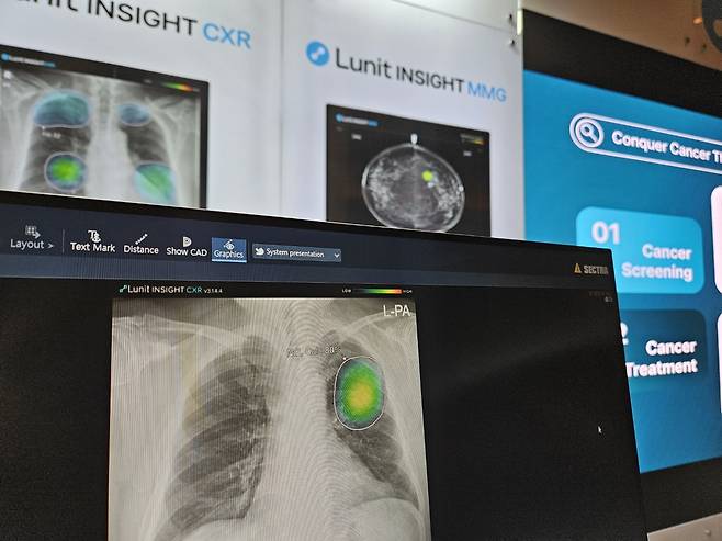 AI 설루션 '루닛 인사이트 CXR'에 표시된 폐 결절 위치 [촬영 김현수]