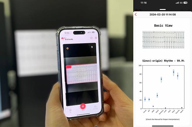 별도의 장비 없이 심전도 검사 결과 이미지를 스마트폰으로 촬영(왼쪽)하면 인공지능모델이 이를 분석해 응급질환 판단을 지원(오른쪽)한다.[분당서울대병원 제공]
