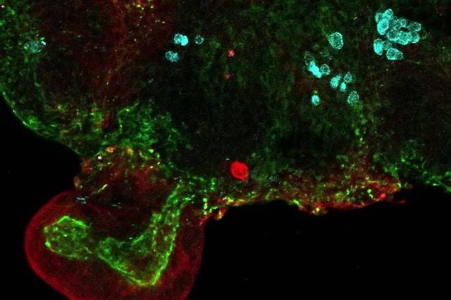 양수에 포함된 줄기세포로 만든 태아의 소장 오가노이드./영 UCL