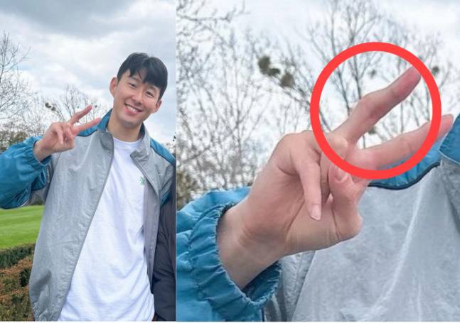 7일 손흥민이 팬과 찍은 사진이 소셜미디어에 올라왔다. 손흥민의 가운데 손가락이 부어 있는 모습. [온라인 커뮤니티]