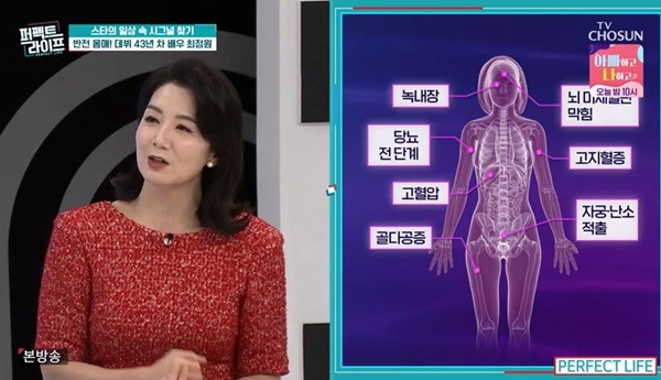 TV조선 ‘퍼펙트라이프’ 캡처