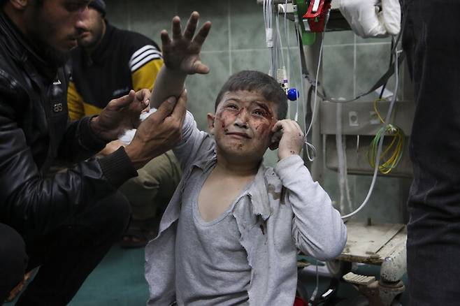 이스라엘군의 폭격에 다친 팔레스타인 어린이가 24일 가자지구 라파흐의 병원에서 치료를 받고 있다. 라파흐/AP 연합뉴스