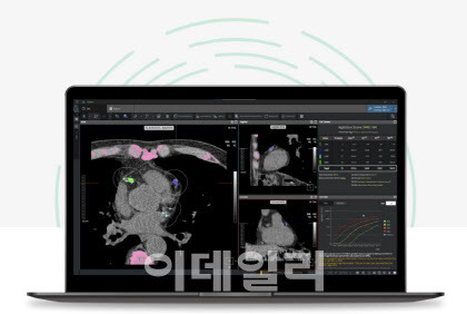 AI 기반 관상동맥석회화 자동 분석 솔루션 ‘에이뷰 CAC’(AVIEW CAC)(사진=코어라인소프트 공식 홈페이지 갈무리)