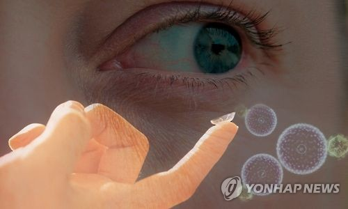 콘택트렌즈 [연합뉴스]