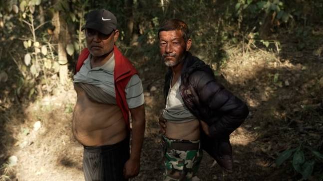 '콩팥마을'로 불리는 네팔의 '호세마을' 주민들이 신장 적출 수술 흔적을 보여주고 있다. [스카이뉴스]